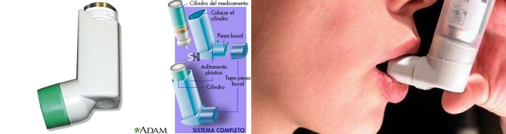 Dispositivos para inhalación: técnica correcta de inhalación